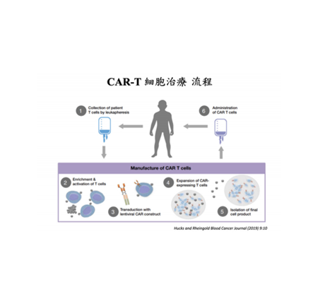 台灣首例CAR-T細胞治療成功