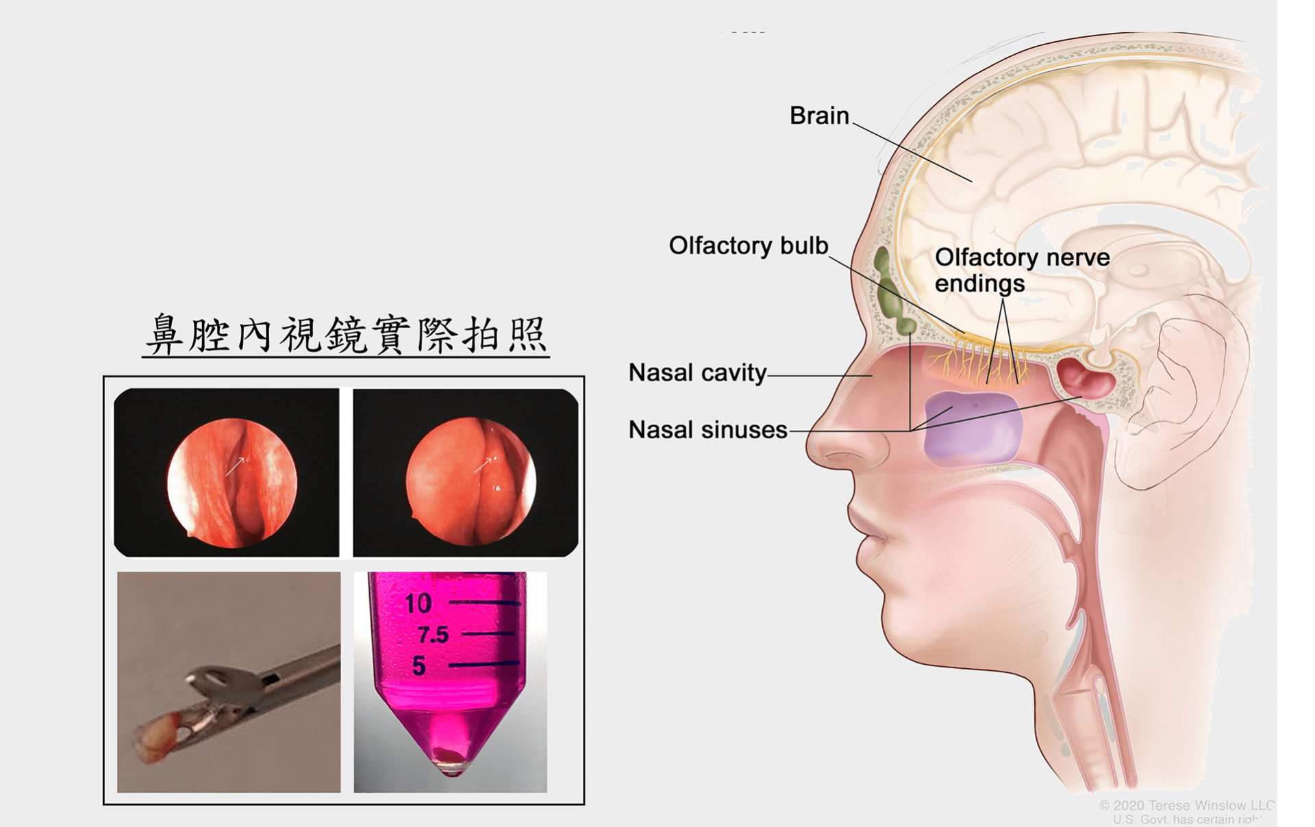 鼻腔內視鏡照