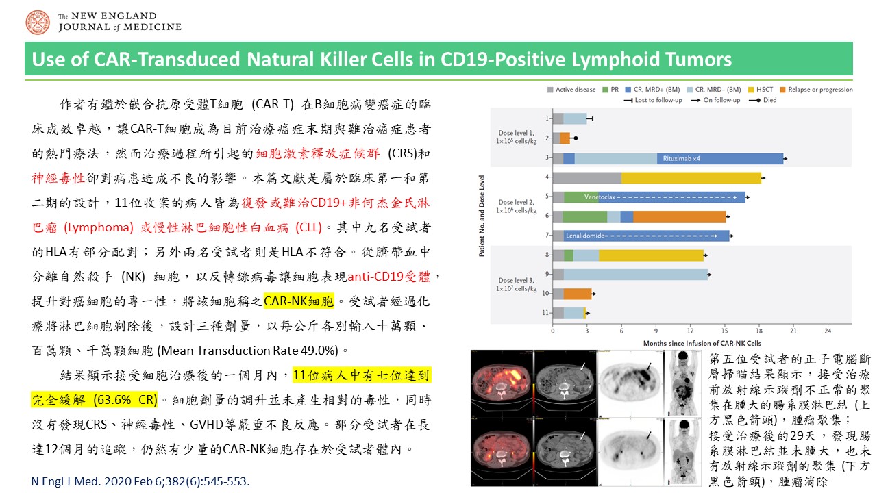 嵌合抗原受體NK細胞療法應用於表現CD19抗原的淋巴腫瘤