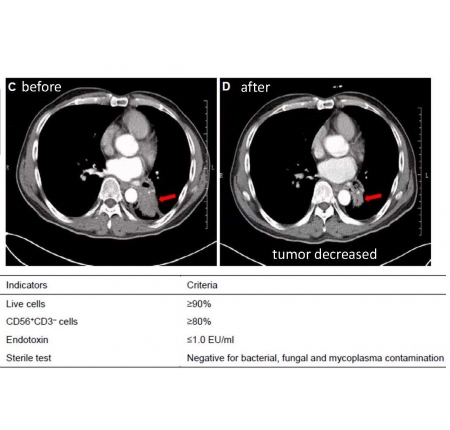 晚期非小細胞肺癌 (NSCLC) 是高度致命的癌症，過去治療的選擇只有化學治療或標靶治療，免疫檢查點抑制劑已被證實是一種有效的免疫治療。